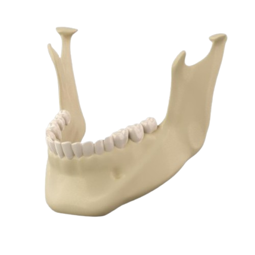 Orthognatic Surgery, corrects jaw misalignment to improve chewing, speech, and facial aesthetics.